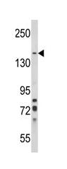 Anti-SorCS1 antibody (ab93331) at 1/100 dilution + K562 cell line lysate at 35 µg