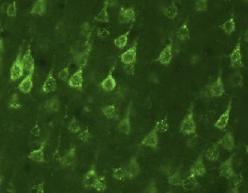 Immunofluorescent staining for SorLA in rat cortical neurons using Rabbit polyclonal to SorLA (ab16642). The staining is cytoplasmic and punctate in these cortical neurons. Protocol details: Rats were intracardially perfused with 4% paraformaldehyde. Whole brain tissue was post-fixed overnight in the same fixative, and cryoprotected in 20% sucrose and frozen in OCT. 30µm coronal sections were cut by cyrostat for use in fre floating IHC. Primary antibody ab16642 was incubated overnight at 1/500 at room temperature. Secondary antibody Alexa fluor 488 1/1000 was incubated for 2 hours at room temperature.