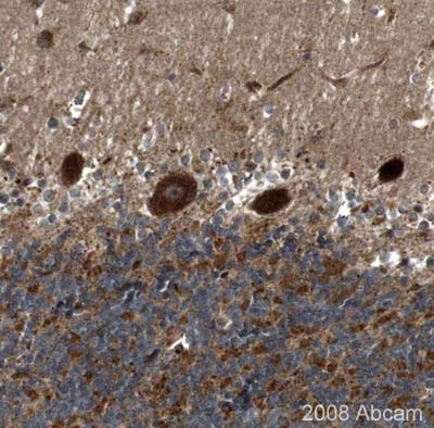 Image courtesy of Human Protein Atlas ab16642 staining SorLA in paraffin embedded human cerebellum tissues, showing a strong signal in the granular and molecular cell layers and Purkinje cells. Paraffin embedded human cerebellum sections (4µm) were incubated with ab16642 (1/40 dilution) for 30 mins at room temperature. Antigen retrieval was performed by heat induction in citrate buffer pH 6.ab16642 was tested in a tissue microarray (TMA) containing a wide range of normal and cancer tissues as well as a cell microarray consisting of a range of commonly used, well characterised human cell lines. Further results for this antibody can be found at www.proteinatlas.org.