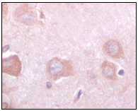ab63336 at 1/500 dilution with DAB staining on normal human cerebrum tissue; paraffin embedded. Showing cytoplasma location.