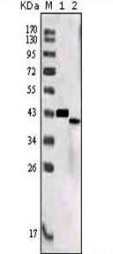All lanes : Anti-SorLA antibody [7D7B11] (ab63573) at 1/500 dilutionLane 1 : Immunising protein (recombinant fusion fragment)Lane 2 : CHO-K1 cell lysate transfected with immunising protein (recombinant fusion fragment)