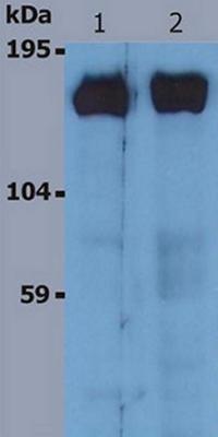 All lanes : Anti-SOS1 antibody [SOS-1] (ab64595) at 1 µg/mlLane 1 : K562 human Caucasian chronic myeloid leukemia cell lineLane 2 : RAJI human Burkitt lymphoma cell linePerformed under reducing conditions.