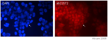 The image shows staining of the nuclei of NTERA cells using the Sox1 antibody, ab22572.