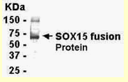 Anti-SOX15 antibody (ab55992) at 1/2000 dilution + E coli-derived fusion protein as test antigen. SecondaryGoat anti-IgY-HRP dilution at 1/1000 dilution