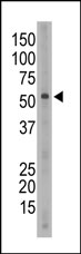Anti-SIGLEC6 antibody (ab38581) at 1/100 dilution + Mouse spleen tissue lysate