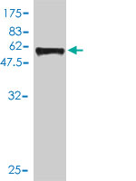 Western blot against tagged recombinant protein immunogen using ab56755 SIX2 antibody at 1ug/ml.