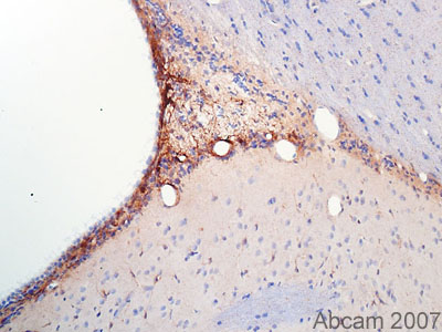 Immunohistochemistry (Formaldehyde/PFA-fixed paraffin-embedded sections) using SOX21 antibody (ab24604)on Rat Tissue sections (adult brain lateral ventricle subventricular zone). Antigen retrieval step: Heat mediated. Blocking step: 1% BSA for 10 mins at RT°C. ab24604 used at 1/300 incubated for 16 hours. Secondary Antibody: biotin conjugated anti rabbit IgG (1/300). NB: Sox21 protein expression showin in this image is in concurrs with published mRNA positivity in the subventricular zone and rostro-migratory stream in the adult rat.