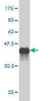 Western blot against tagged recombinant protein immunogen using ab56860 SOX30 antibody at 1ug/ml.
