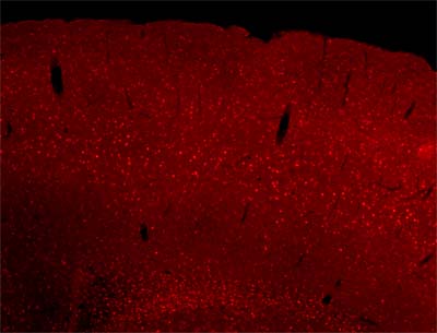 ab30455 staining Sox6 in post-natal mouse brain sections. PFA-fixed post-natal mouse brain sections were incubated for 30 minutes in blocking solution followed by an overnight incubation with ab30455 (1/500) at 4°C. No staining was observed in sections obtained from Sox6 knockout mice.