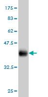 Western blot against tagged recombinant protein immunogen using ab57197 SOX8 antibody at 1ug/ml.