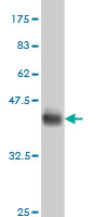 Western blot against tagged recombinant protein immunogen using ab57201 SOX8 antibody at 1ug/ml.