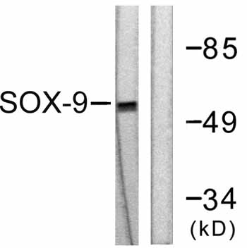 All lanes : Anti-SOX9 antibody (ab59265) at 1/500 dilutionLane 1 : extracts from 293 cells, treated with PBS (60mins)Lane 2 : extracts from 293 cells, treated with PBS (60mins) with immunizing non-phosphopeptide