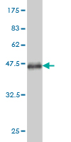 Western blot against tagged recombinant protein immunogen using ab58191 SOX9 antibody at 1ug/ml.