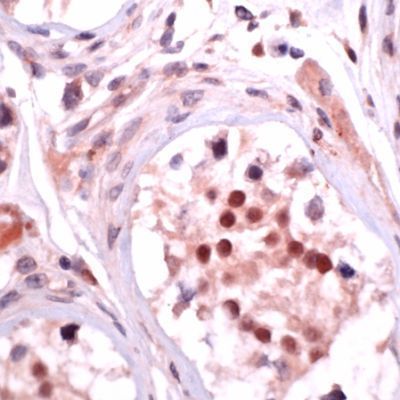 Human testis stained with Anti-SOX9 (ab36748) at 1/50 dilution by Immunohistochemistry (FFPE-sections) for 30 min at room temperature.