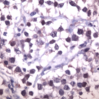 Ab41833 staining human SOX9 in human testis by immunohistochemistry using formalin fixed, paraffin embedded tissue.