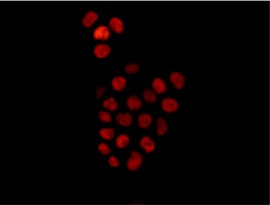 Immunofluorescence analysis of SW480 cells labeling SOX9 using ab182579 at 1/250 dilution. A Goat anti rabbit IgG (Alexa Fluor555) at 1/200 dilution was used as secondary antibody. Cells were fixed with 4% paraformaldehyde.
