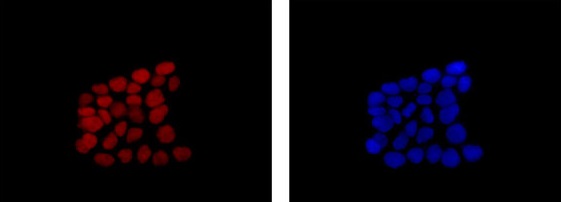 Immunofluorescence analysis of 4% paraformaldehyde-fixed Caco2 cells, labeling SOX9 with ab184547 at 1/500 dilution (red). Alexa Fluor®555-conjugated goat anti rabbit IgG was used as a secondary antibody at 1/200 dilution. Nuclei were counterstained with DAPI (blue).
