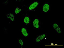 ab77441 at 10µg/ml staining SP1 in HeLa cells by Immunofluorescence.