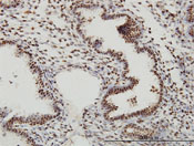 ab77441 staining SP1 in human endometrium by Immunohistochemistry, Formalin-fixed, Paraffin-embedded tissue.