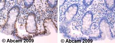 Ab6082 staining human normal colon. Staining is localised to the nucleus.Left panel: with primary antibody at 4 ug/ml. Right panel: isotype control.Sections were stained using an automated system DAKO Autostainer Plus , at room temperature. Sections were rehydrated and antigen retrieved with the Dako 3-in-1 antigen retrieval buffer citrate pH 6.0 in a DAKO PT Link. Slides were peroxidase blocked in 3% H2O2 in methanol for 10 minutes. They were then blocked with Dako Protein block for 10 minutes (containing casein 0.25% in PBS) then incubated with primary antibody for 20 minutes and detected with Dako Envision Flex amplification kit for 30 minutes. Colorimetric detection was completed with diaminobenzidine for 5 minutes. Slides were counterstained with Haematoxylin and coverslipped under DePeX. Please note that for manual staining we recommend to optimize the primary antibody concentration and incubation time (overnight incubation), and amplification may be required.