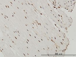 SP1 antibody (ab58202) used in immunohistochemistry at 3ug/ml on formalin fixed and paraffin embedded human small Intestine.