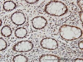 SP1 antibody (ab58199) used in immunohistochemistry at 1ug/ml on formalin fixed and paraffin embedded human colon.