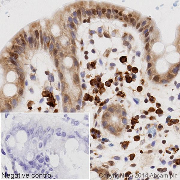 IHC image of SP1 staining in a section of formalin-fixed paraffin-embedded Hu_Colon_Norm*, performed on a Leica Bond system using the standard protocol B. The section was pre-treated using heat mediated antigen retrieval with sodium citrate buffer (pH6, epitope retrieval solution 1) for 20 mins. The section was then incubated with ab197501 at 1/100 dilution for 15 mins at room temperature and detected using an HRP conjugated ABC system. DAB was used as the chromogen. The section was then counterstained with haematoxylin and mounted with DPX. The inset negative control image is taken from an identical assay without primary antibody.For other IHC staining systems (automated and non-automated) customers should optimize variable parameters such as antigen retrieval conditions, primary antibody concentration and antibody incubation times.*Tissue obtained from the Human Research Tissue Bank, supported by the NIHR Cambridge Biomedical Research Centre