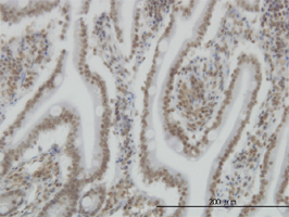 SP110 antibody (ab55337) used in immunohistochemistry at 3ug/ml on formalin fixed and paraffin embedded human small Intestine.