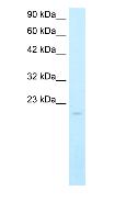 Anti-SP140 antibody (ab24341) at 5 µg/ml + Raji cell lysate.SecondaryHRP conjugated rabbit anti SP140 IgG, at a dilution of 1/50000 - 1/100000. 