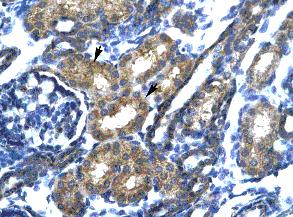 Immunohistochemistry (Formalin/PFA-fixed paraffin-embedded sections) analysis of human kidney tissue labelling SP140 with ab24341 at a concentration of 4-8ug/ml. Renal tubule epithelial cells stained positive are indicated by arrows. Magnification: X400.