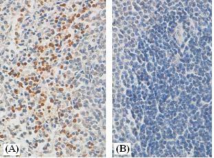 ab90003, at a dilution of 1/100, showing nuclear staining of SP2 transcription factor in formalin fixed, paraffin embedded human fetal tonsil by Immunohistochemistry. (A) No immunizing peptide (B) With immunizing peptide
