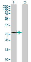 All lanes : Anti-SP2 transcription factor antibody (ab167599) at 1 µg/mlLane 1 : SP2 transcription factor transfected 293T cell lysateLane 2 : Non-transfected 293T cell lysateLysates/proteins at 15 µl per lane.SecondaryGoat anti-Mouse IgG