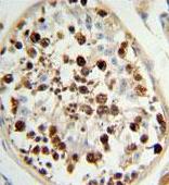 Immunohistochemical analysis of formalin-fixed paraffin-embedded Human testis tissue, labeling SKA3 using ab175951 at a 1/50 dilution, followed by peroxidase conjugation of the secondary antibody and DAB staining.