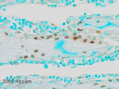 The image shows Osterix staining in rat bone tibiae using ab22552 at 1/100. See Abreview