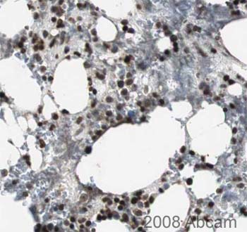 Image courtesy of Human Protein Atlasab22552 staining Sp7 / osterix in human bone marrow tissue. Paraffin embedded human bone marrow tissue was incubated with ab22552 (1/25 dilution) for 30 mins at room temperature. Antigen retrieval was performed by heat induction in citrate buffer pH 6.ab22552 was tested in a tissue microarray (TMA) containing a wide range of normal and cancer tissues as well as a cell microarray consisting of a range of commonly used, well characterised human cell lines. Further results for this antibody can be found at www.proteinatlas.org.