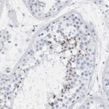 ab121768 at a 1/2500 dilution staining SPACA3 in paraffin embedded Human testis tissue by Immunohistochemistry.