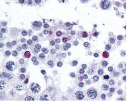 ab51493 at 2.5 ug/ml staining human sperm and spermatids at 60X. Tissue was formalin-fixed and paraffin embedded. The image shows localization of the antibody as the precipitated red signal, with a hematoxylin purple nuclear counterstain.