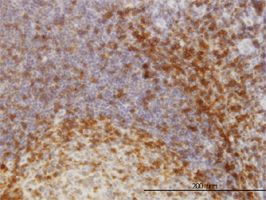 SKAP55 antibody (ab58316) used in immunohistochemistry at 3ug/ml on formalin fixed and paraffin embedded human tonsil.