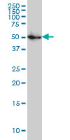 SPG3A antibody (ab58273) at 1ug/lane + IMR-32 cell lysate at 25ug/lane.