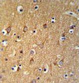 Immunohistochemical analysis of formalin-fixed, paraffin-embedded Human brain tissue, labeling Sphingomyelin Synthase 2 with ab189443 at 5 µg/ml, followed by peroxidase conjugation of the secondary antibody and DAB staining.
