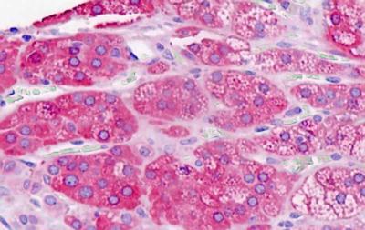 Immunohistochemical analysis of formalin-fixed, paraffin-embedded Human adrenal tissue, labeling Sphingomyelin Synthase 2 with ab189443 at 5 µg/ml.