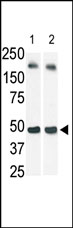 Lane 1 :  c-myc tagged SPHK1 antibodyLane 2 :  Anti-SPHK1 antibody (ab37980) at 0.25 mg/mlLane 1 : transfected 293 cell lysateLane 2 : transfected 293 cell lysate