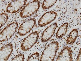 splicing factor 1 antibody (ab58077) used in immunohistochemistry at 5ug/ml on formalin fixed and paraffin embedded human colon.