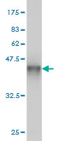 Western blot against tagged recombinant protein immunogen using ab58077 splicing factor 1 antibody at 1ug/ml.