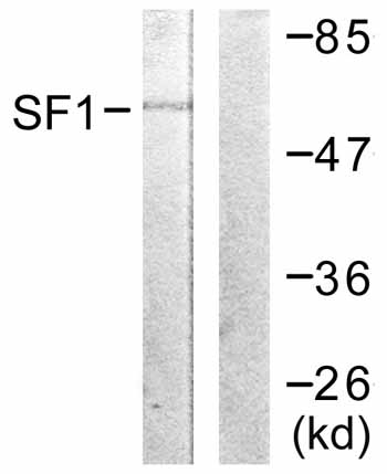 All lanes : Anti-splicing factor 1 antibody (ab59263) at 1/500 dilutionLane 1 : extracts from COLO205 cellsLane 2 : extracts from COLO205 cells with immunizing peptide