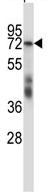 Anti-splicing factor 1 antibody (ab123389) at 1/100 dilution + HepG2 cell line lysates at 35 µg