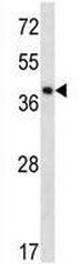 Anti-SPOPL antibody (ab171126) at 1/100 dilution + UM cell line lysate at 35 µgdeveloped using the ECL technique