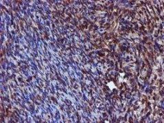 ab119402 at 1/150 dilution staining SPR in paraffin-embedded Human ovary tissue by Immunohistochemistry.