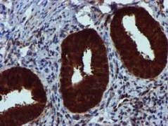 ab119402 at 1/150 dilution staining SPR in paraffin-embedded Human endometrium tissue by Immunohistochemistry.