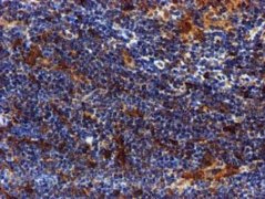 ab119402 at 1/150 dilution staining SPR in paraffin-embedded Human lymphoma tissue by Immunohistochemistry.